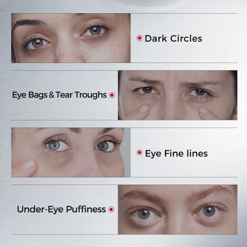 Патчи для глаз от темных круго – обзор и цена Collagen Eye Patch